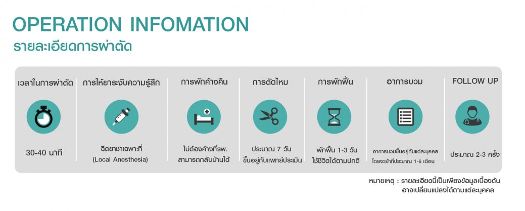 OP-info-ตาสองชั้น OP-info-ตาสองชั้น