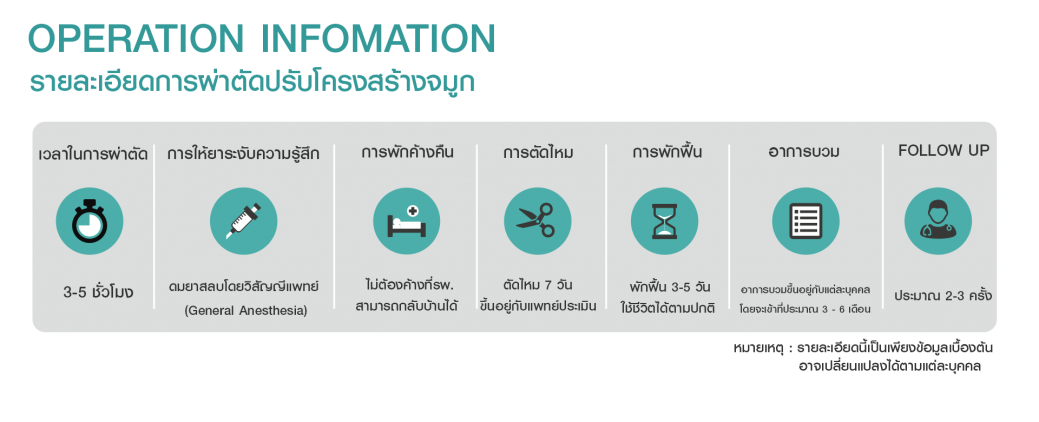 OP info รีคอน OP info รีคอน