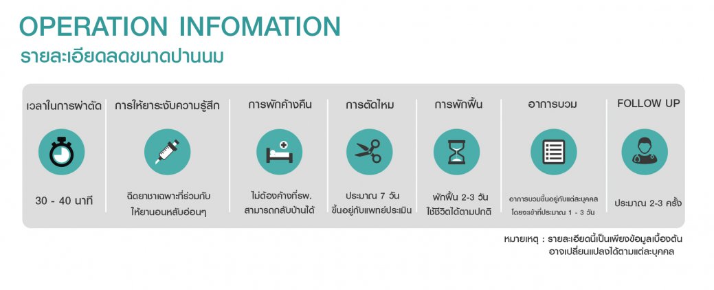 OP info ลดขนาดปานนม OP info ลดขนาดปานนม