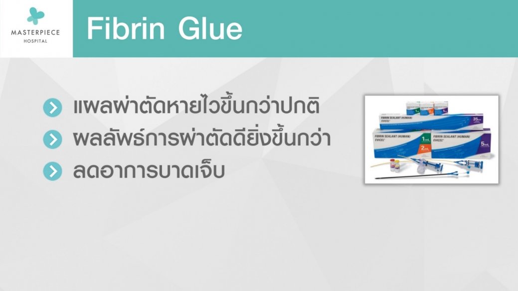 Fibrin Glue Fibrin Glue