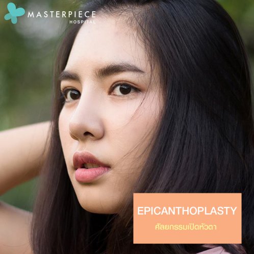 ผ่าตัดหัวตา เปิดตากว้างขึ้น ผ่าตัดหัวตา เปิดตากว้างขึ้น