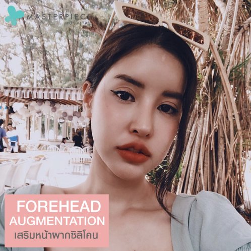 เสริมหน้าผากซิลิโคน เสริมหน้าผากซิลิโคน