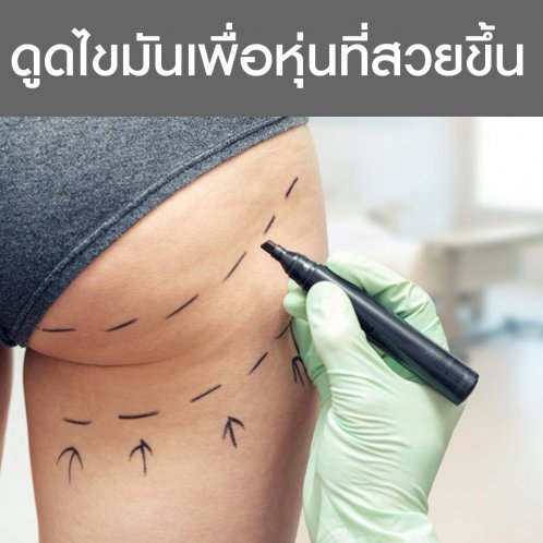ดูดไขมันเพื่อหุ่นที่สวยขึ้น ดูดไขมันเพื่อหุ่นที่สวยขึ้น