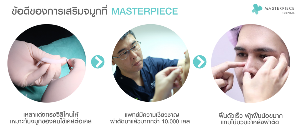 ข้อดีจมูกซิลิโคนที่MTP PNG ข้อดีจมูกซิลิโคนที่MTP PNG
