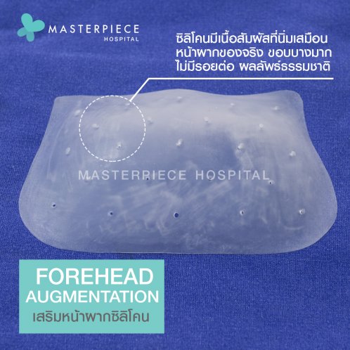 ซิลิโคนหน้าผาก ซิลิโคนหน้าผาก