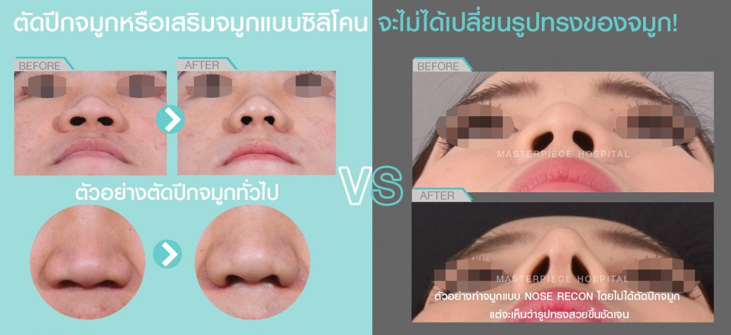 ตัดปีกกับรีคอน ตัดปีกกับรีคอน