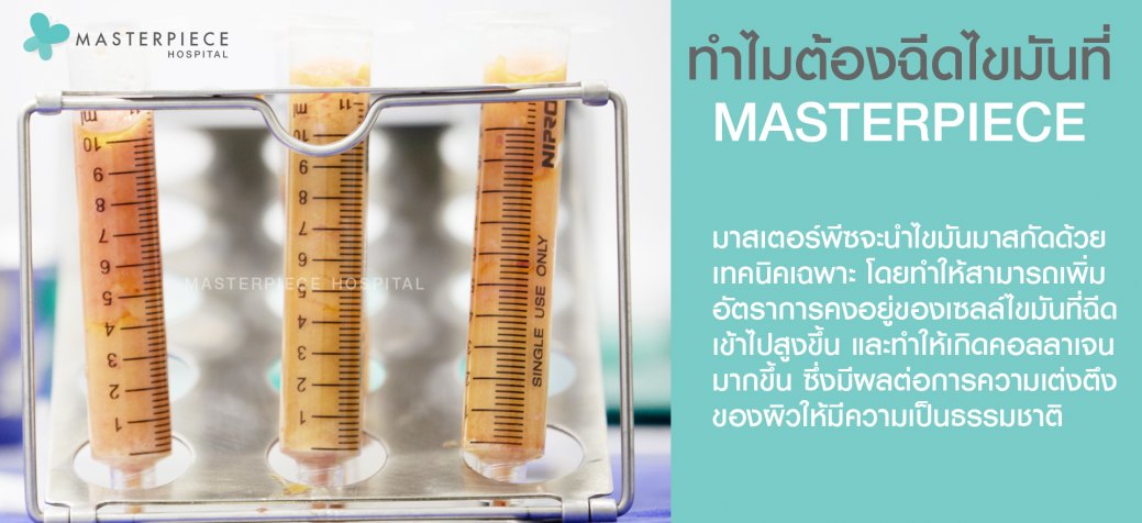 ทำไมต้องฉีดไขมันที่ MASTERPIECE ทำไมต้องฉีดไขมันที่ MASTERPIECE