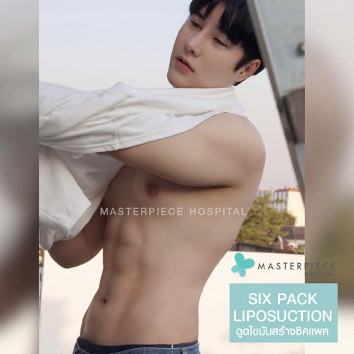 ดูดไขมัน ซิกแพค (SIX PACK LIPOSUCTION) ดูดไขมัน ซิกแพค (SIX PACK LIPOSUCTION)