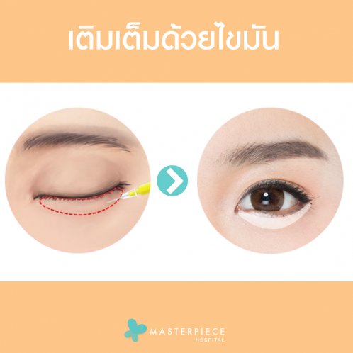 ไขมัน ไขมัน
