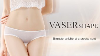 vaser shape