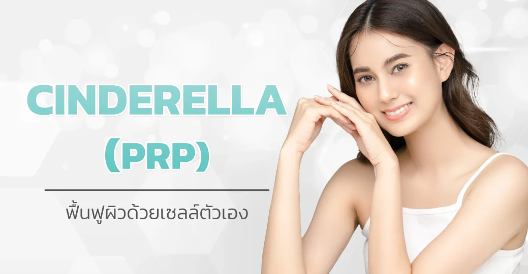 Cinderella PRP