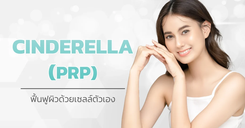 Cinderella PRP