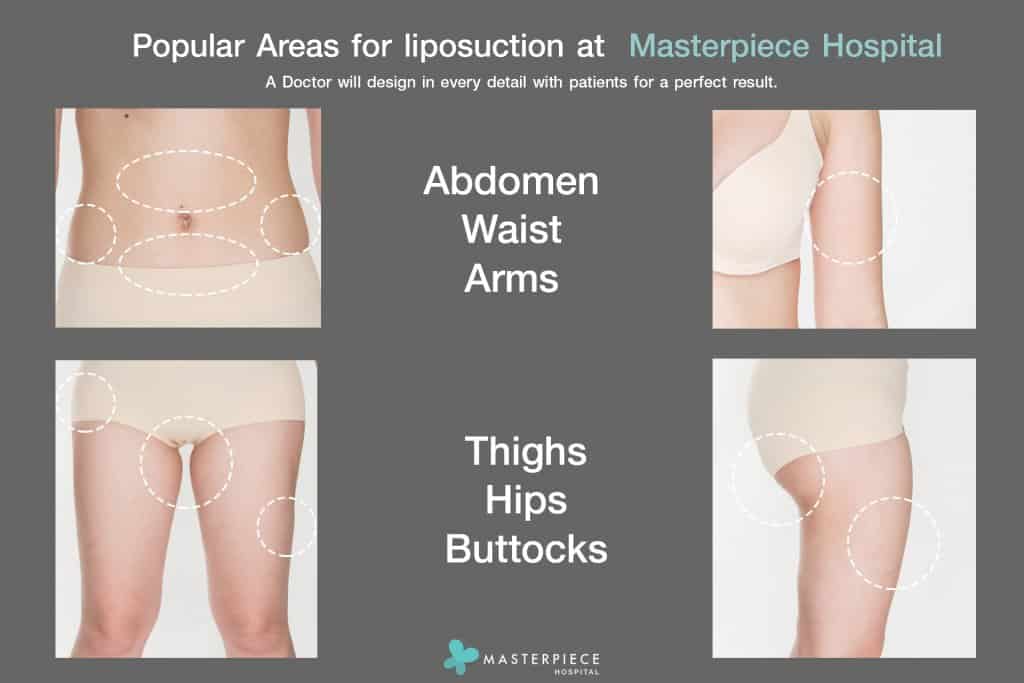 Body Vaser Liposuction