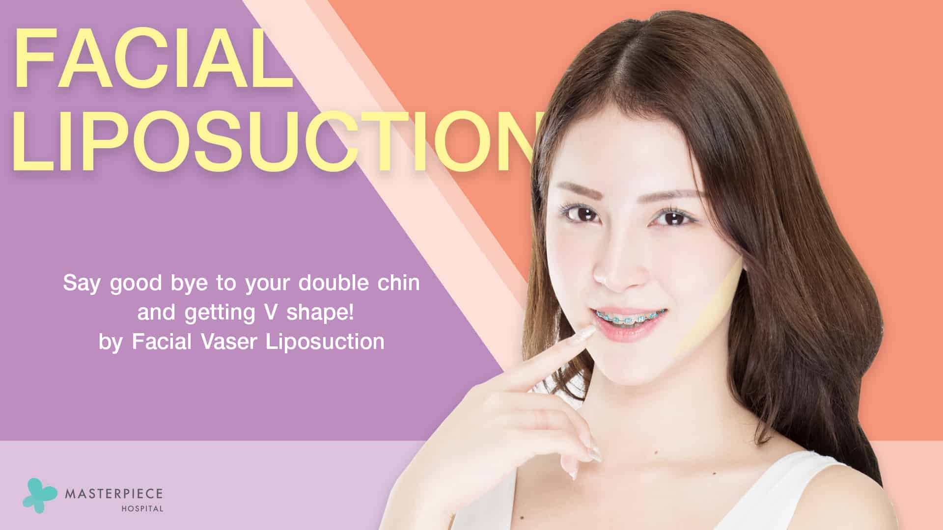 FACIAL VASER LIPOSUCTION