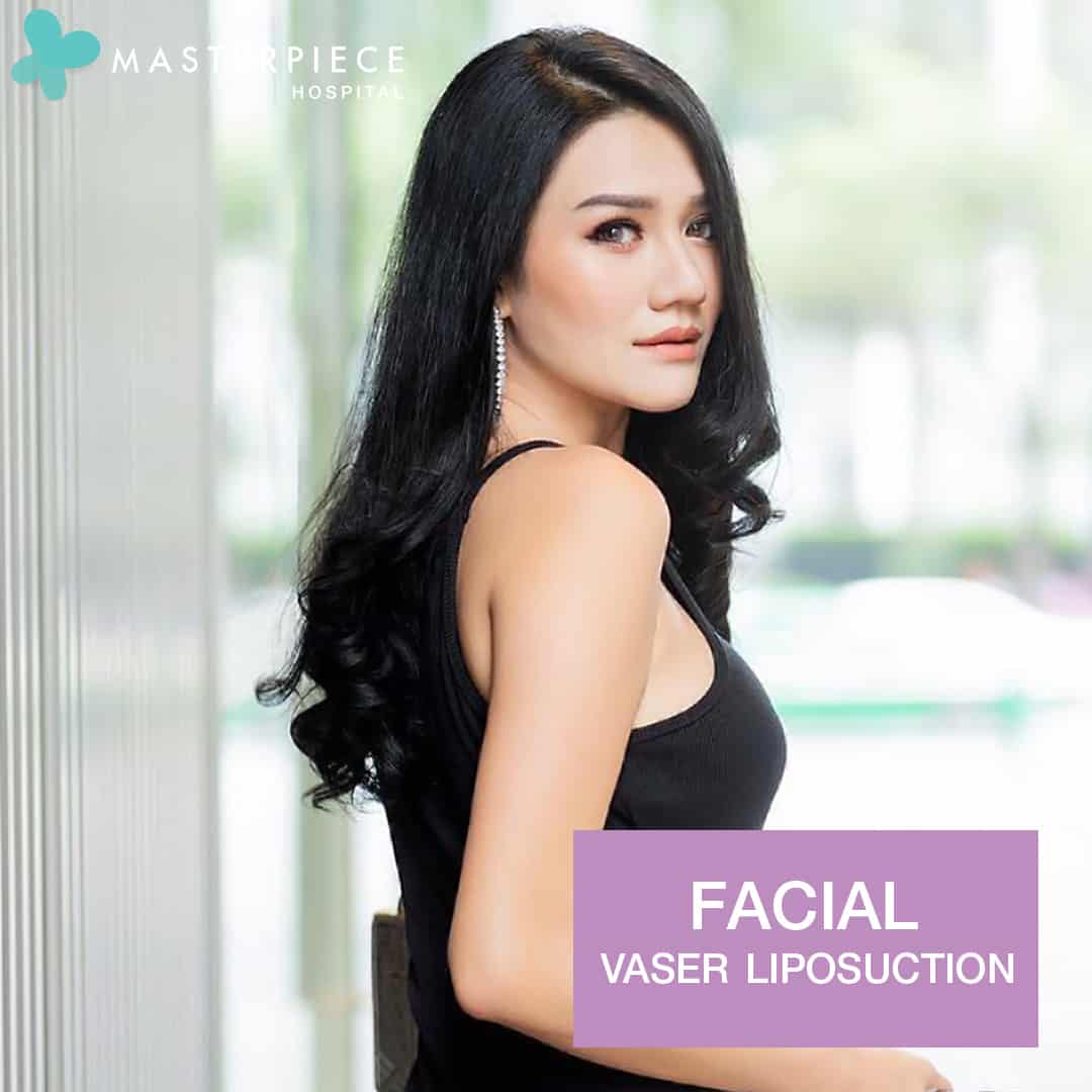 Facial Vaser Liposuction