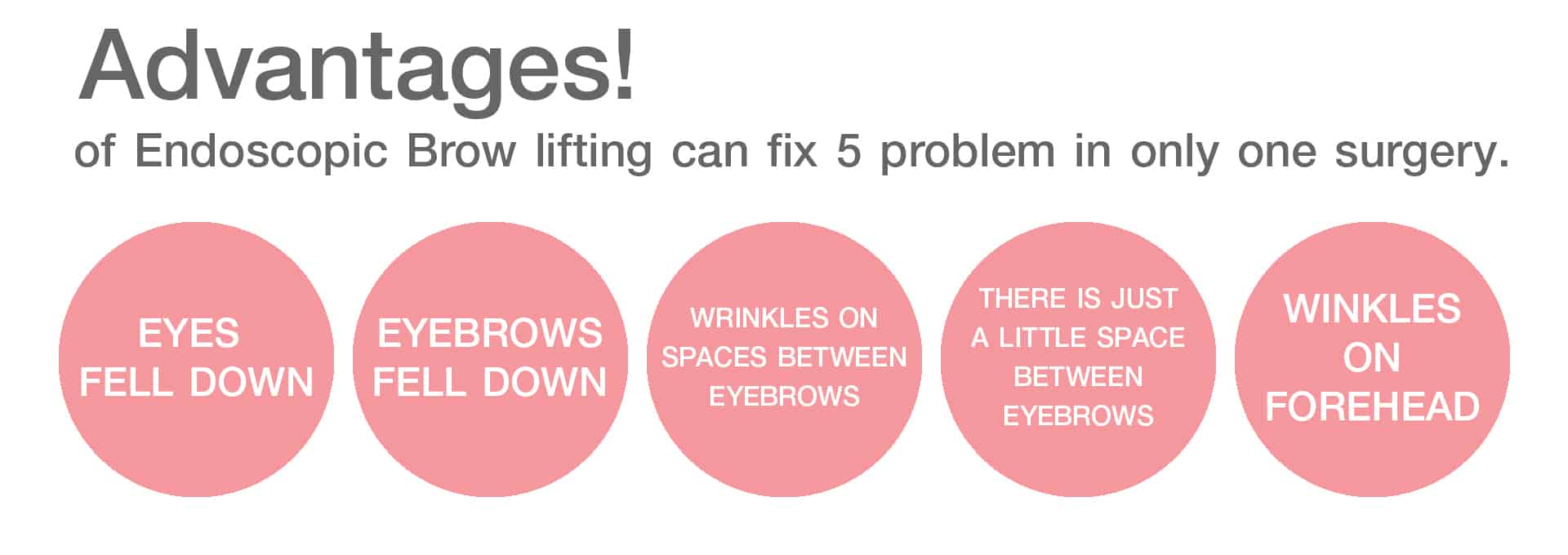 Advantages of Endoscopic Brow lifting can fix 5 problem in only one surgery.