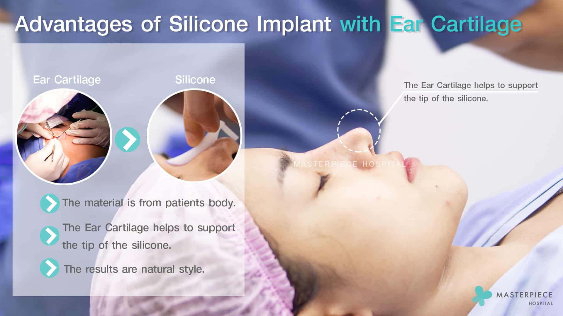 Advantages of Silicone Implant with Ear Cartilage