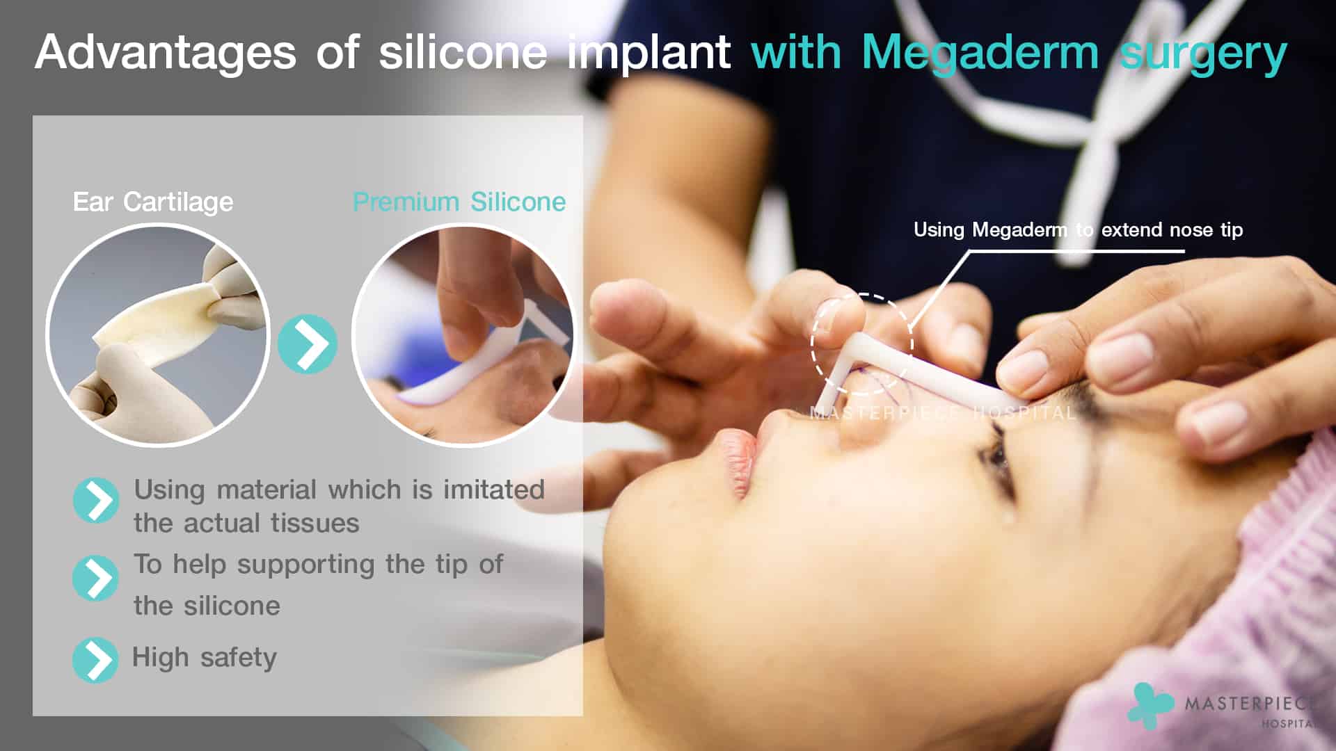 Advantages of silicone implant with Megaderm surgery