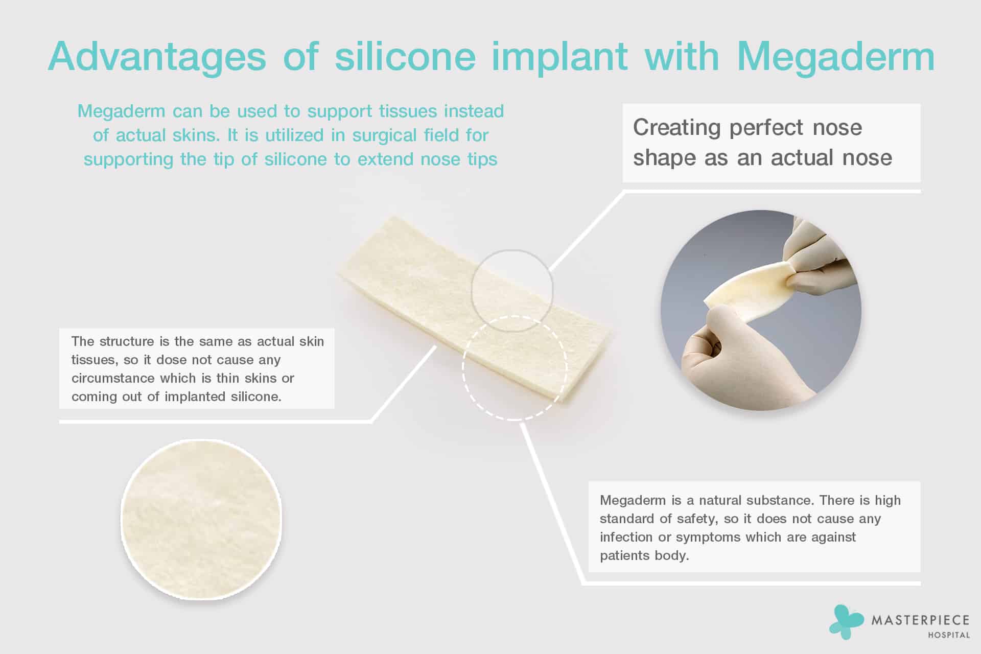 Advantages of silicone implant with Megaderm
