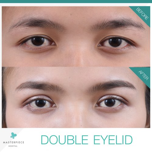 BA Double EYES 1