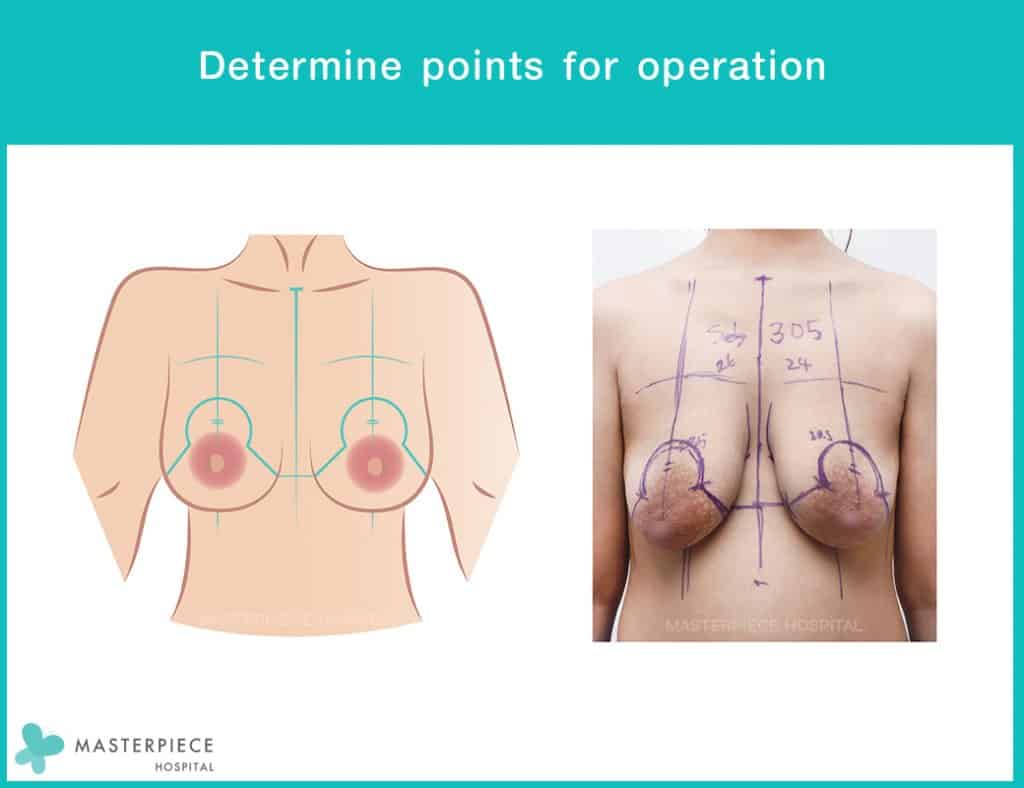 Determine points for operation