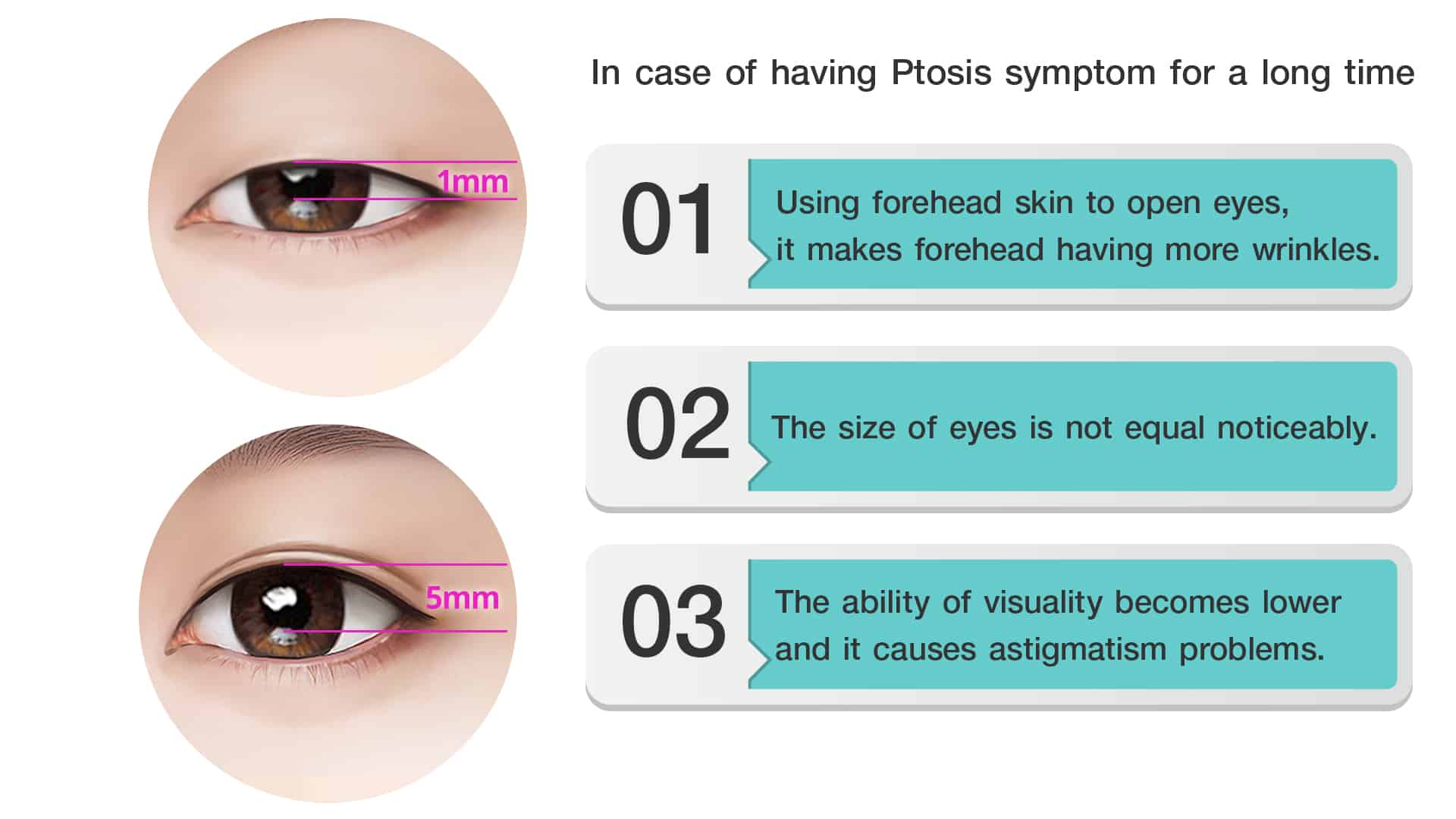 In case of having Ptosis symptom for a long time