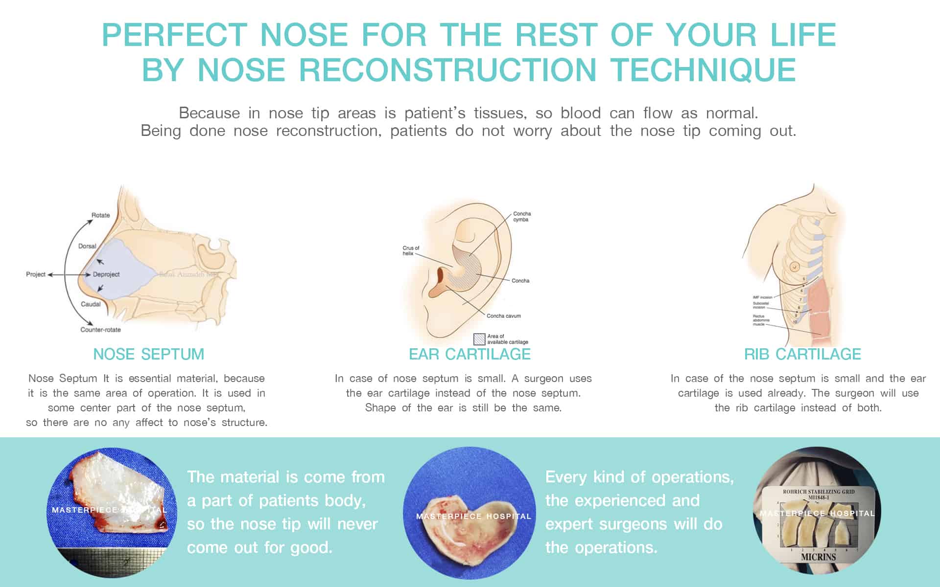 Perfect nose for the rest of your life by Nose Reconstruction Technique