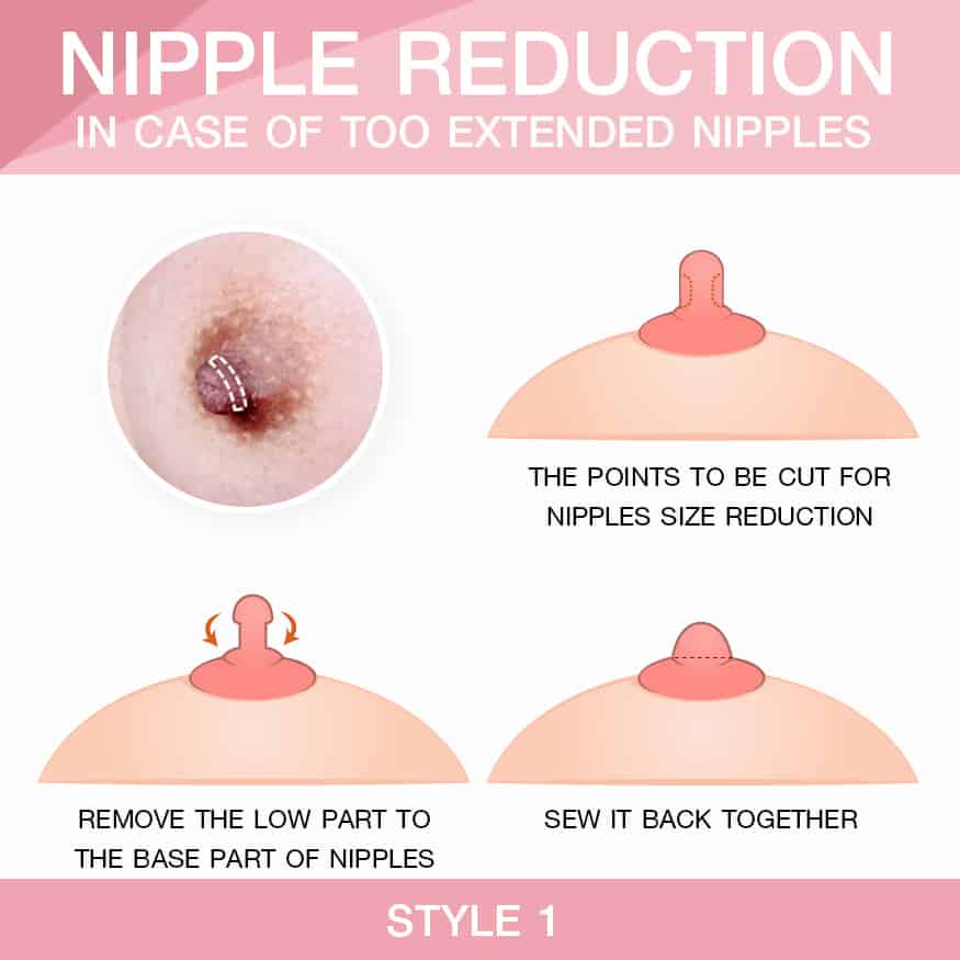 Style1 In case of too extended nipples