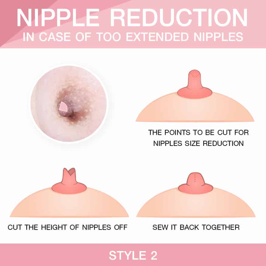 Style2 In case of too extended nipples