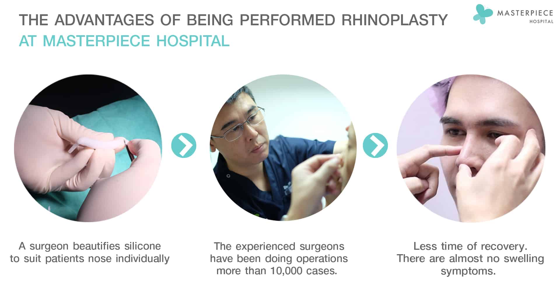 The advantages of being performed rhinoplasty at Masterpiece Hospital