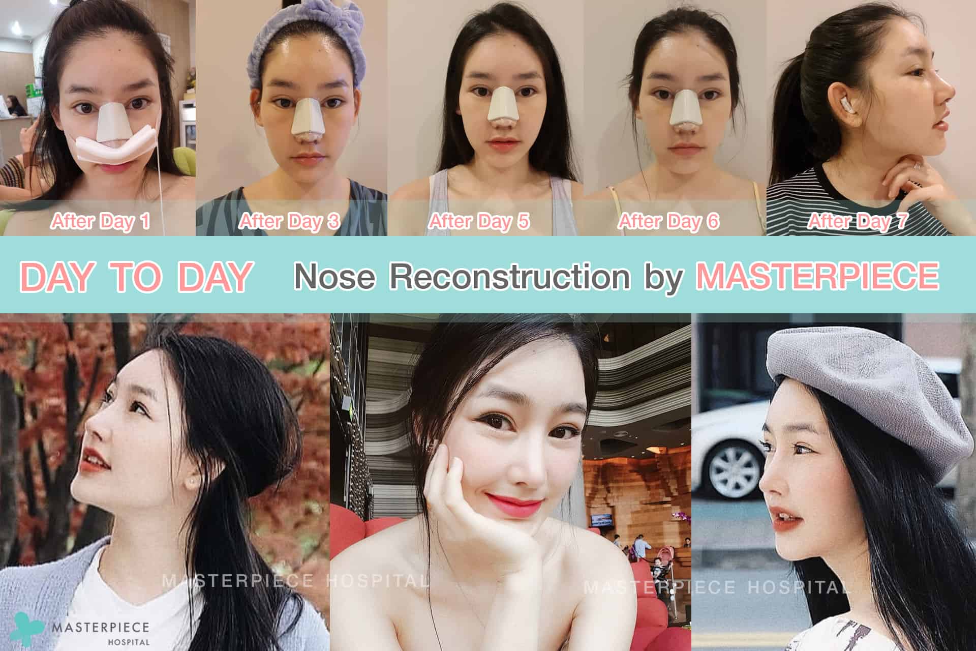 day to day Nose Reconstruction