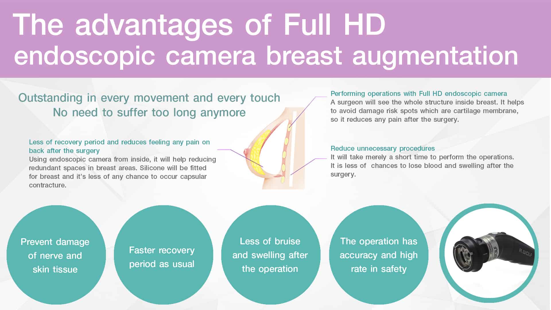 Breast Augmentation with Full HD endoscopic camera