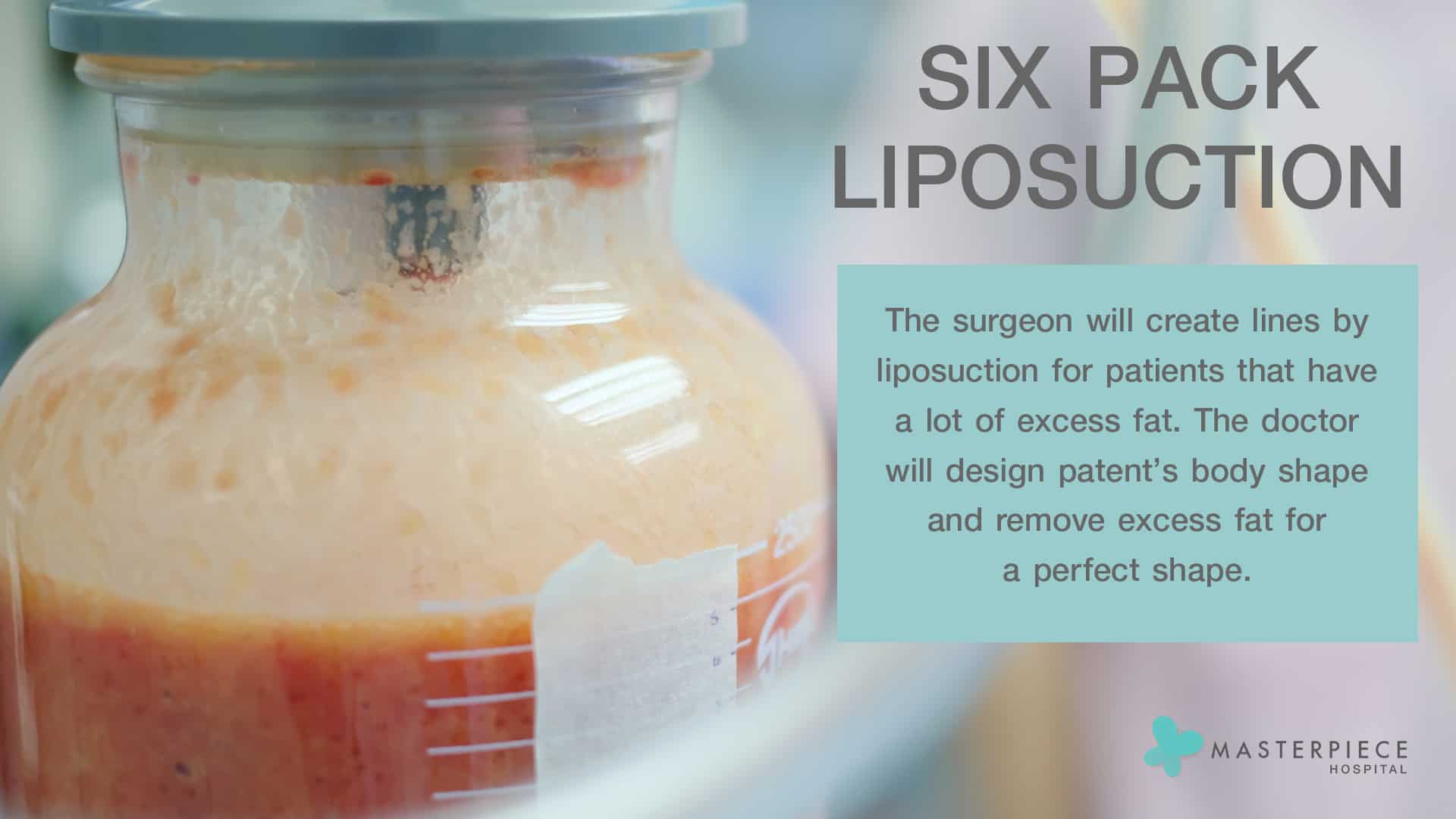 liposuction