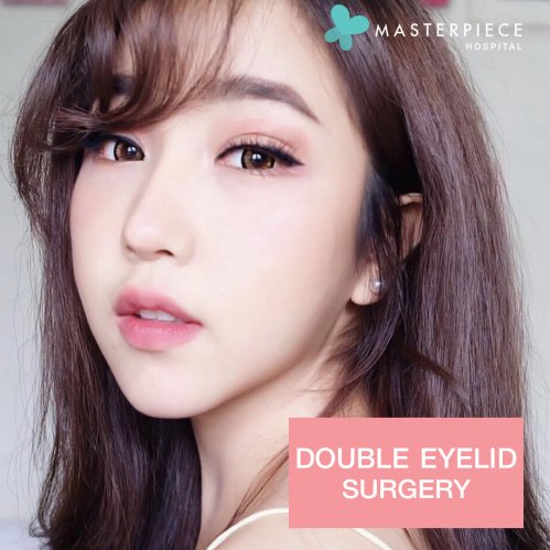 Double Eyelid Sugery