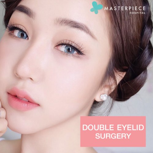 Double Eyelid Sugery