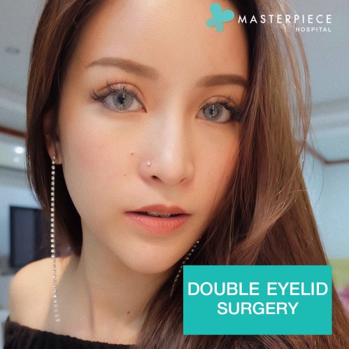 DOUBLE EYES SURGERY