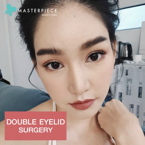 Double eyelids