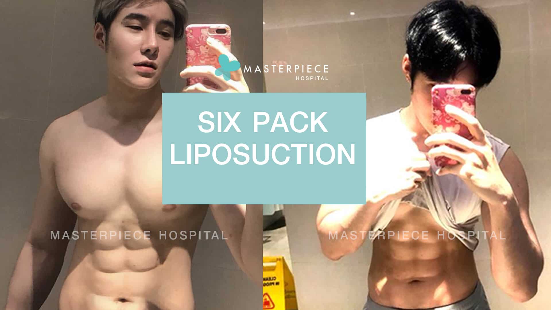 Six pack Liposuction review