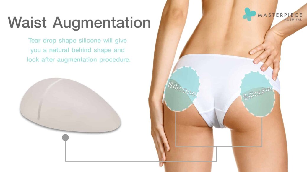 BUTTOCK AUGMENTATION - Masterpiece Hospital