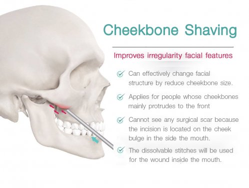 Cheekbone Shaving