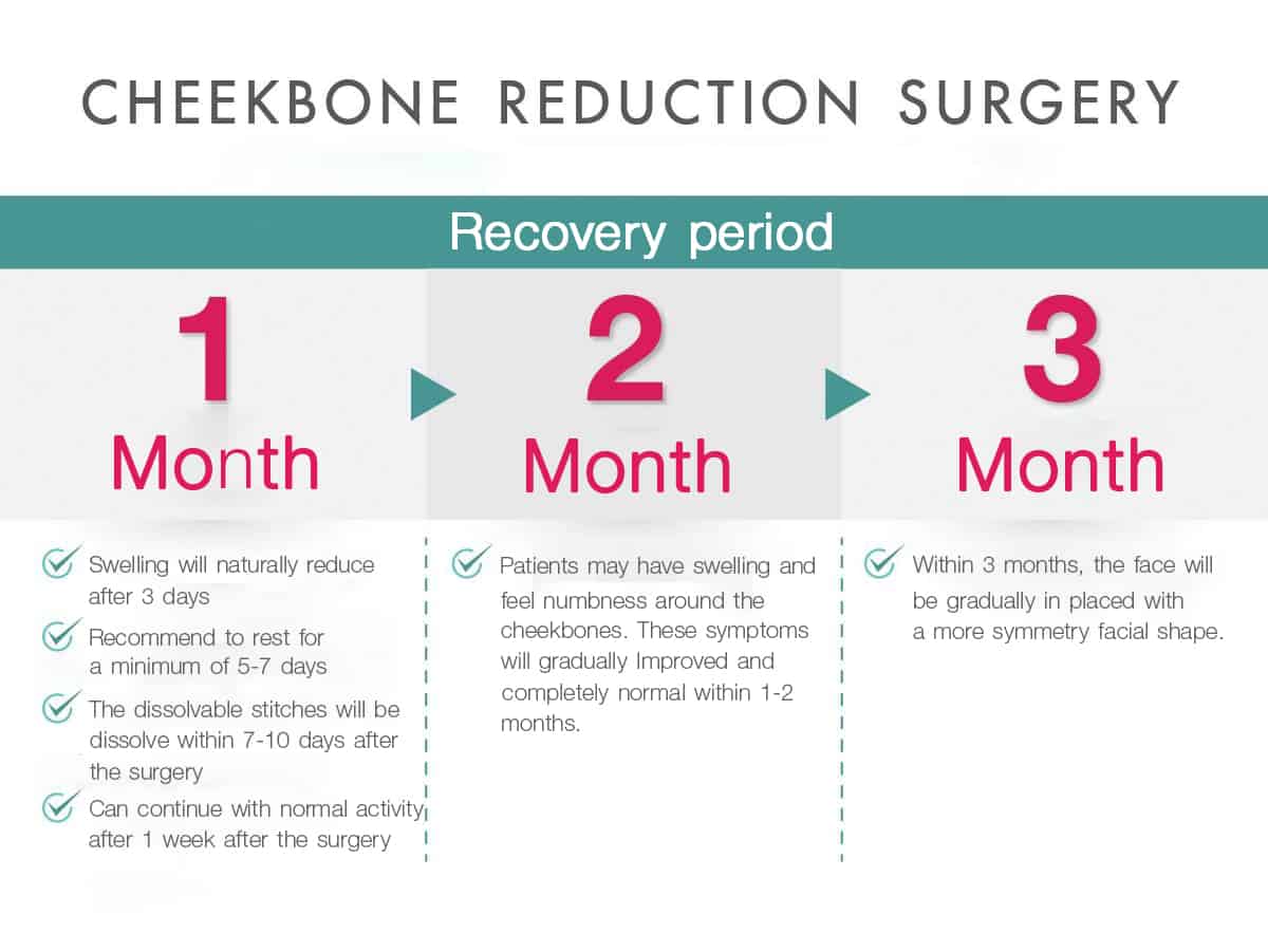 Cheekbone reduction surgery