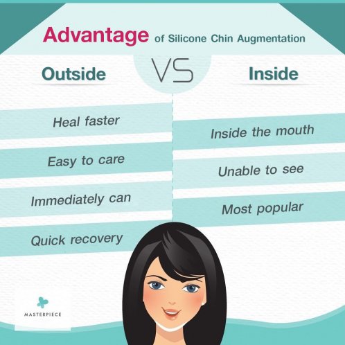 Advantage of Silicone Chin Augmentation