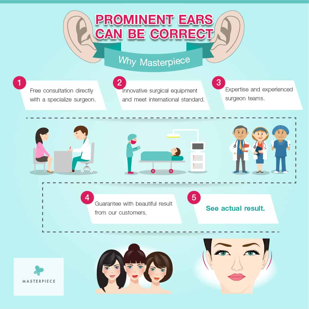 Info Otoplasty
