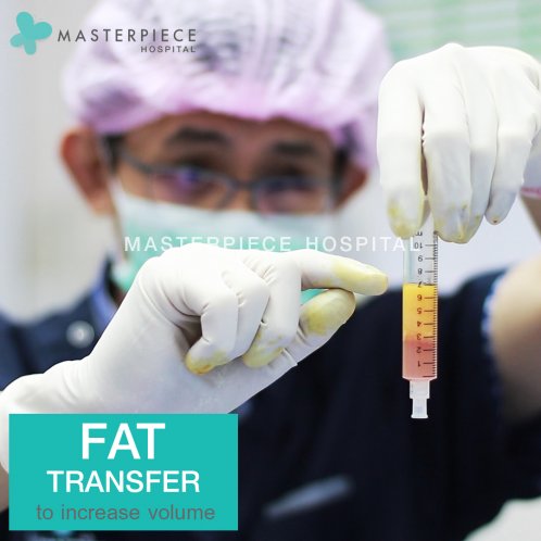 Fat transfer