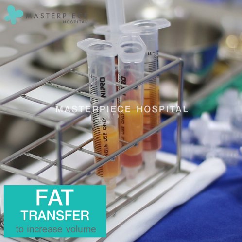 Fat transfer