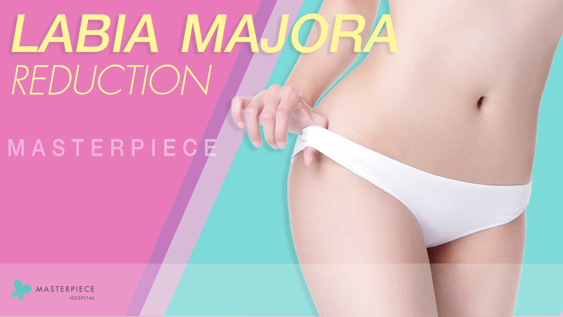 LABIA MAJORA REDUCTION