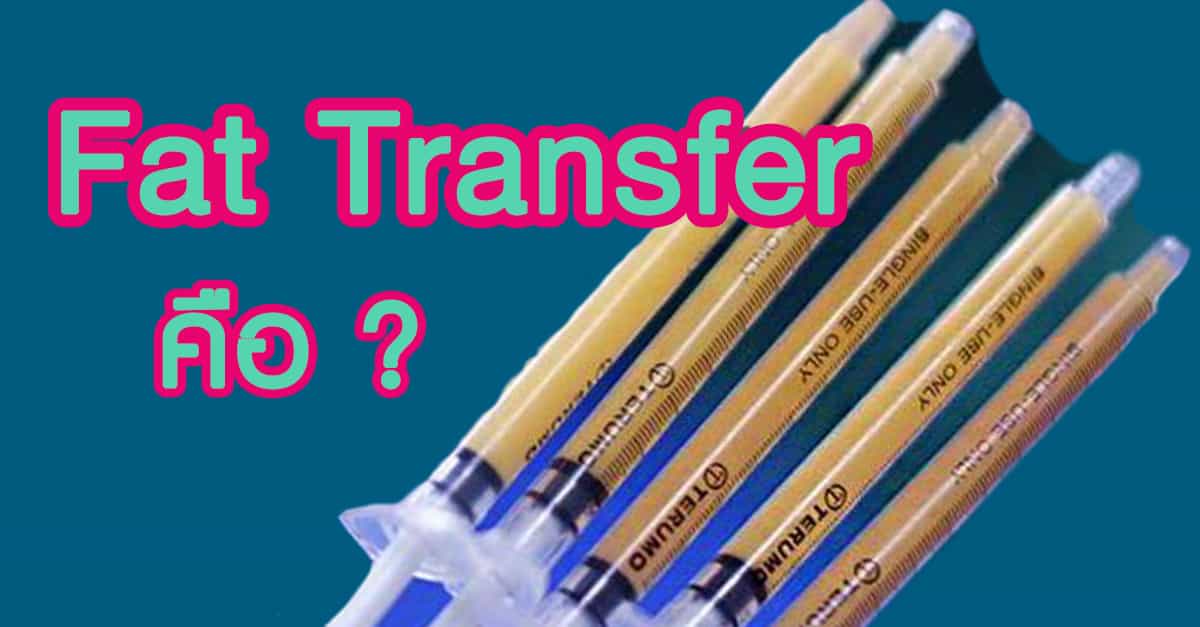 Fat transfer คืออะไร?