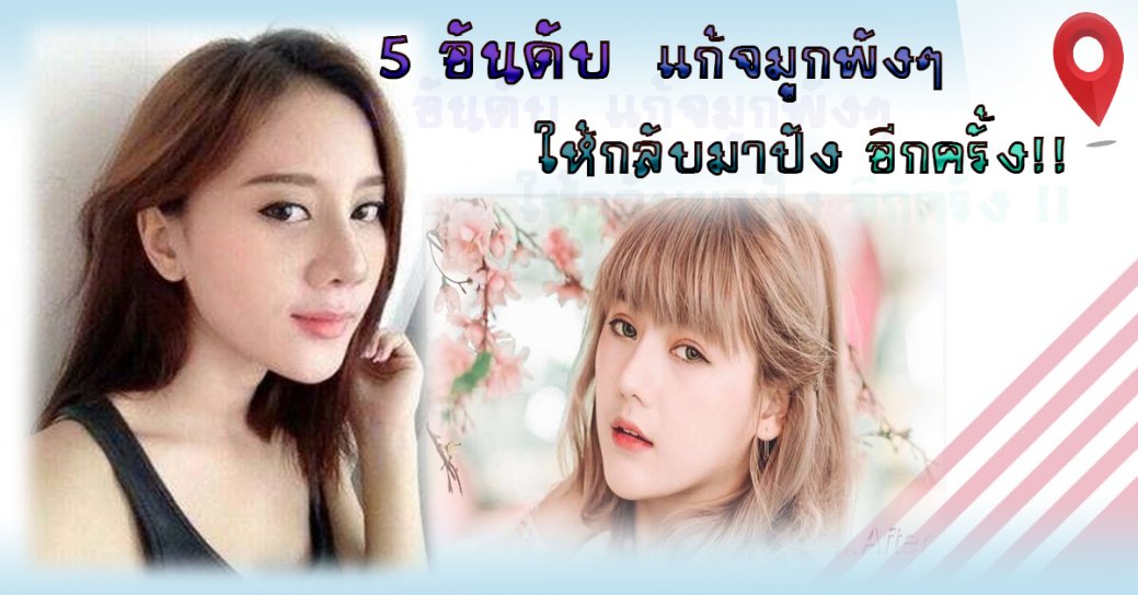 ปกไซต์ปกติ-บทความ-5-อันดับ-แก้จมูกพังๆให้กลับมาปังอีกครั้ง