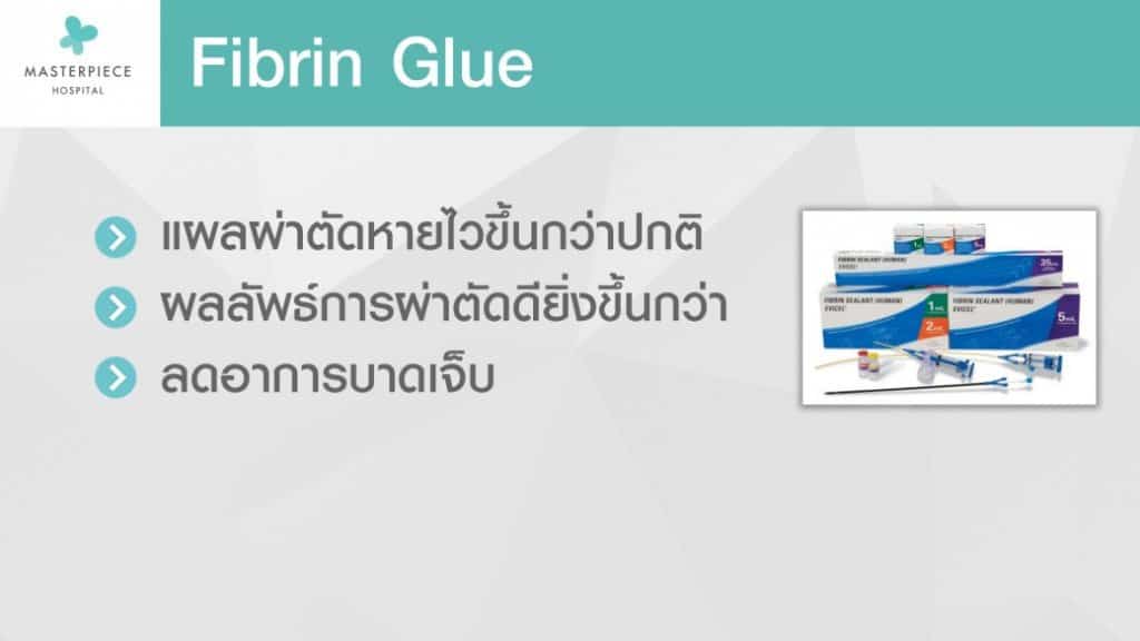 ไฟบริน Fibrin Masterpiece Hospital