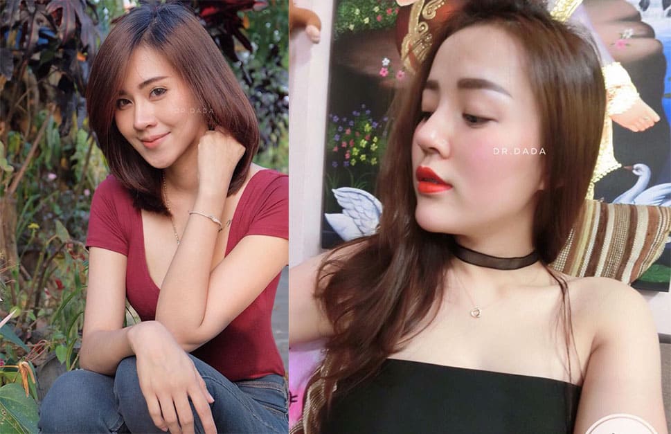 ปักหมุด !! 5 Location “เสริมจมูก” ปี 2019 ฝีมือหมอขั้นเทพ !